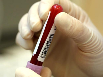 ΣΟΚ: Σταμάτησαν τις εξετάσεις για το AIDS ΣΟΚ: Σταμάτησαν τις εξετάσεις για το AIDS