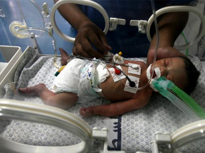 Πέθανε το μωρό-σύμβολο της Γάζας