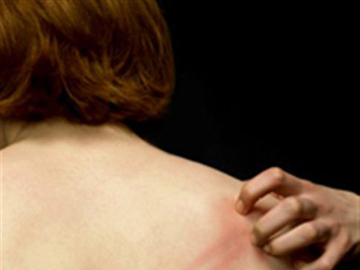 Η ανυπόφορη νευροδερματίτιδα