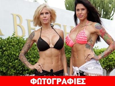 Οι δίδυμες αδελφές με τον εθισμό στις πλαστικές επεμβάσεις