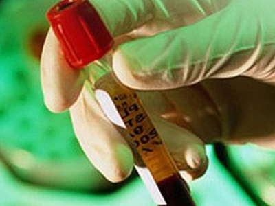 ΗΠΑ: Μολυσμένο φάρμακο προκάλεσε το θάνατο πέντε ατόμων