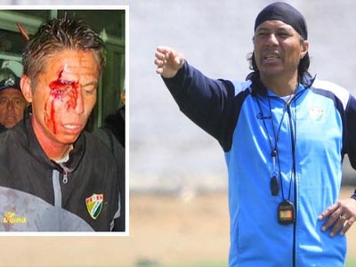 Έδειραν παίκτη επειδή έχασε πέναλτι