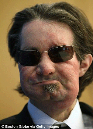 Μετά τις πλαστικές επεμβάσεις