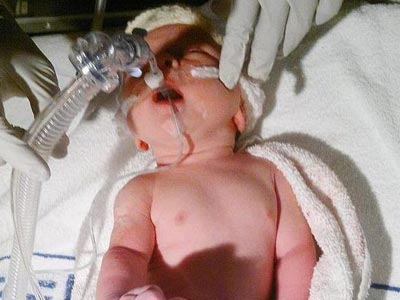 Ζει με την καρδιά στην δεξιά πλευρά!