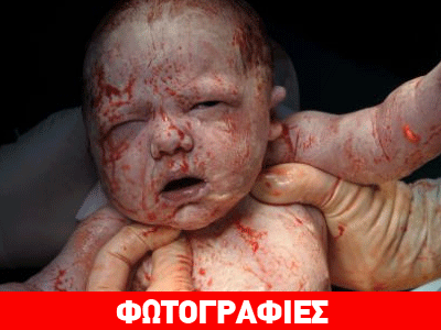 Το θαύμα της γέννησης μέσα από τον φωτογραφικό φακό