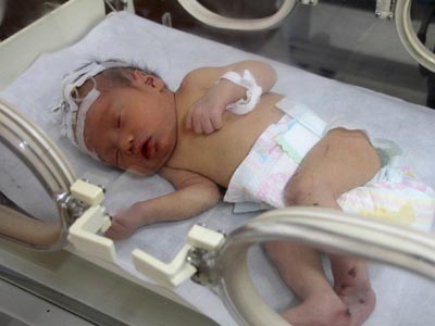 Βγήκε από το νοσοκομείο το μωρό που πέταξαν στον υπόνομο