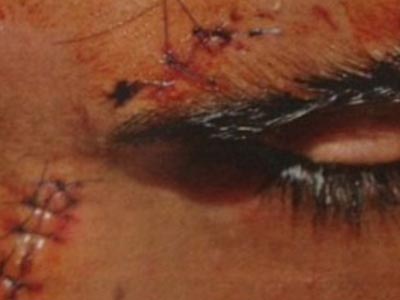 Παραλίγο να συλληφθεί το θύμα ρατσιστικής επίθεσης