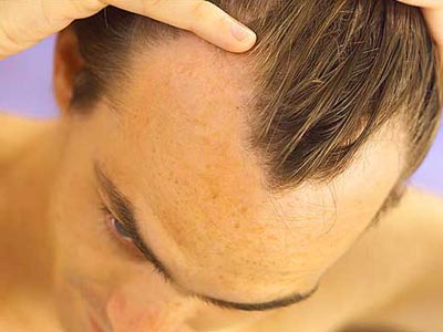 Εποχική τριχόπτωση και φθινόπωρο