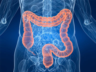 Ιάσιμος σε ποσοστό 90% είναι ο καρκίνος του παχέος εντέρου όταν διαγνωστεί έγκαιρα Ιάσιμος σε ποσοστό 90% είναι ο καρκίνος του παχέος εντέρου όταν διαγνωστεί έγκαιρα