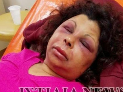 Κούνεβα: «Οι βασανιστές της Αναστασίας πρέπει να απομονωθούν»