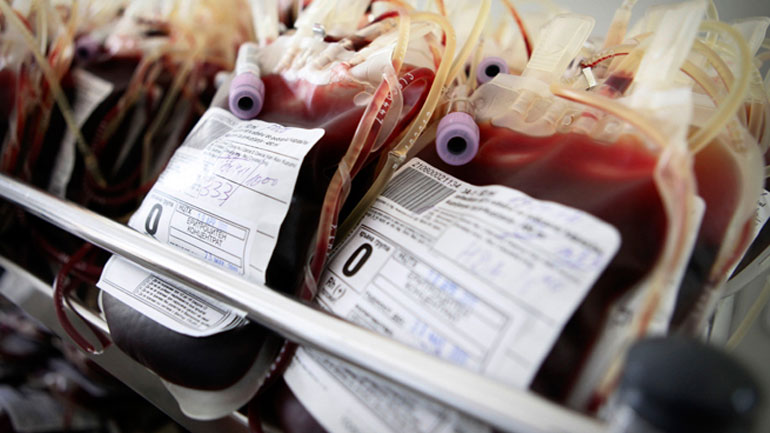 Σε κρίσιμη κατάσταση νεαρός από την Ξάνθη μετά από σοβαρό τροχαίο