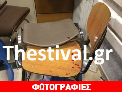 Επίθεση κουκουλοφόρων σε μέλη της ΔΑΠ ΝΔΦΚ στη Θεσσαλονίκη