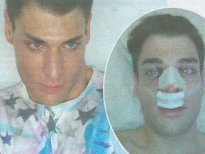 Η ατυχία του μοντέλου λίγο πριν τα καλλιστεία