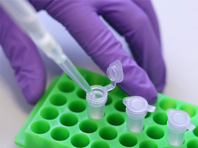 Ποιο είναι το πιο ισχυρό κίνητρο εμβολιασμού κατά του HPV;