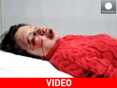 Θύμα άγριου ξυλοδαρμού κορυφαία δημοσιογράφος της Ουκρανίας Θύμα άγριου ξυλοδαρμού κορυφαία δημοσιογράφος της Ουκρανίας