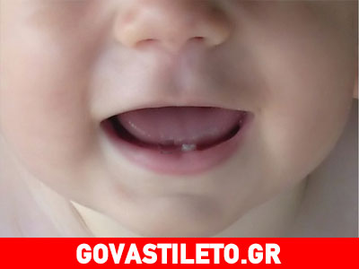 Μάθετε πότε να περιμένετε κάθε δοντάκι του παιδιού