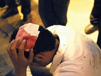 Αναζητείται σύζυγος υποψήφιας της Χρυσής Αυγής για ξυλοδαρμό μεταναστών