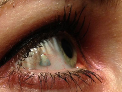 Κάνουν «piercing» στο μάτι!