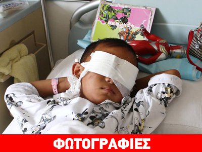 Κίνα: Συγγενής το άτομο που αφαίρεσε τα μάτια του εξάχρονου