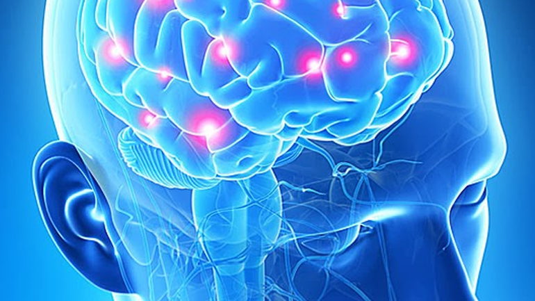 Παγκόσμια Ημέρα Εγκεφαλικού σήμερα αφιερωμένη στις γυναίκες