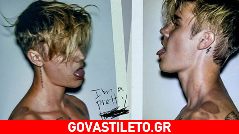 Justin Bieber: Οι φωτογραφίες που σχολιάστηκαν και τα σημάδια στο κορμί του