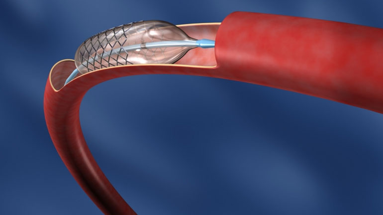 Πως οι νανοΐνες υαλουρονικού οξέος μπορούν να προστατέψουν από τον ιό του AIDS