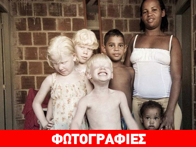 Μελαμψή γυναίκα στη Βραζιλία γεννάει μόνο λευκά παιδιά! Μελαμψή γυναίκα στη Βραζιλία γεννάει μόνο λευκά παιδιά!