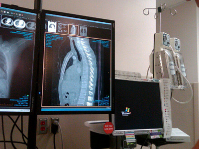 O Berrecloth τραυματίας