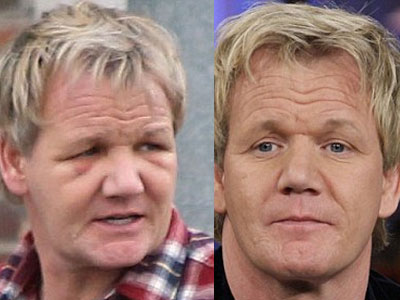 Λέτε να το έπαθε από την εμφύτευση;