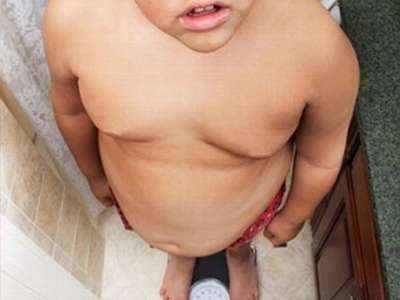 Η παιδική παχυσαρκία