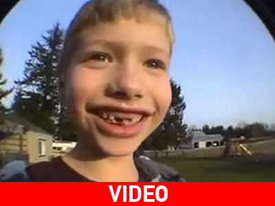 «Πύραυλος» έγινε το δόντι του