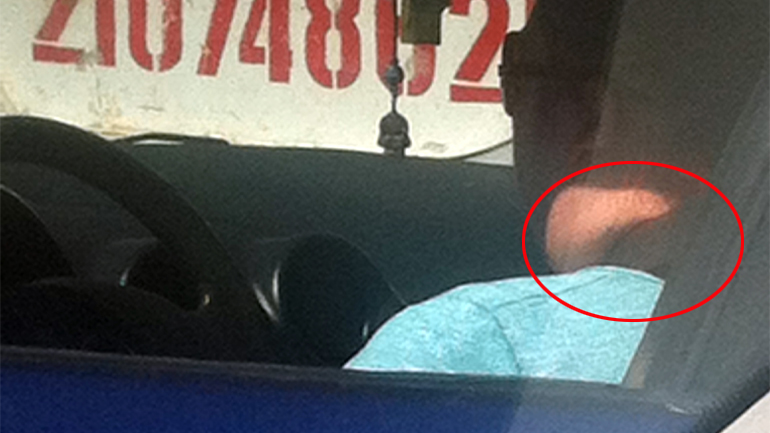 Συμβουλή γιατρού για την ζώνη ασφαλείας…