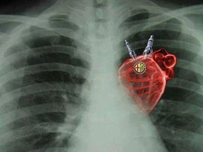 Η ακτινογραφία ενός… Alfisti