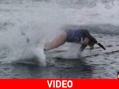 Αυτό πόνεσε!