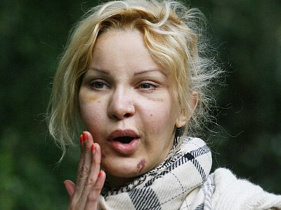 Με… ρέγουλα οι πλαστικές!