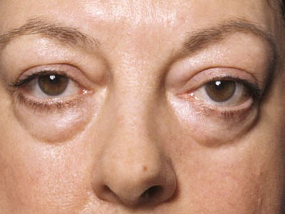 Σακούλες… τέλος!