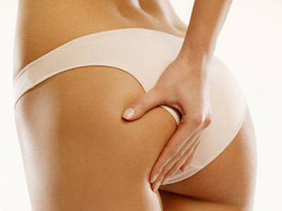 Κυτταρίτιδα: Μακριά κι αγαπημένοι