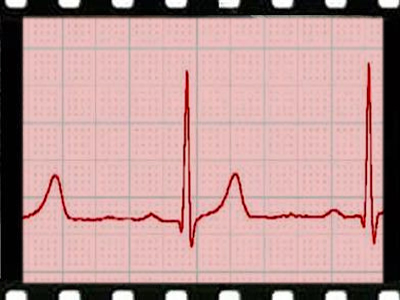 Βιομηχανία κρέατος