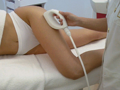 Κυτταρίτιδα: Μπορείτε να την νικήσετε