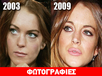 Τα νέα χείλη της Lindsay Lohan