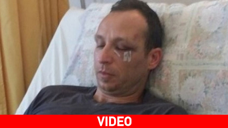 Η στιγμή της επίθεσης σε βάρος του γιατρού Δημήτρη Μακρεά στα Χανιά