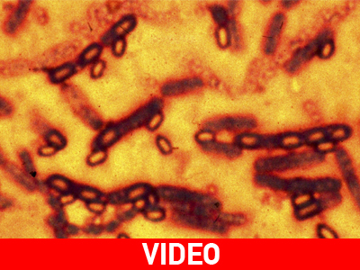 ΗΠΑ: Τουλάχιστον 86 επιστήμονες εκτέθηκαν στο βακτήριο του άνθρακα