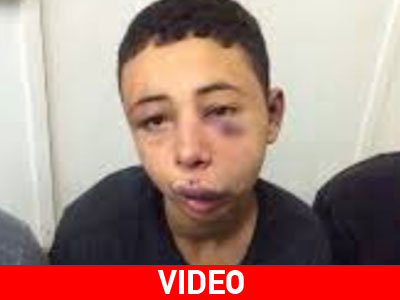 ΗΠΑ: Ζητούν έρευνα για τον ξυλοδαρμό 15χρονου