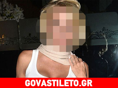 Απίστευτο: Δείτε το αλλαγμένο πρόσωπο της Pamela Anderson