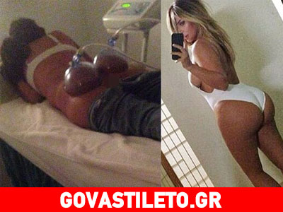 Kim Kardashian: Με αυτήν τη θεραπεία μεγάλωσε τα οπίσθιά της!