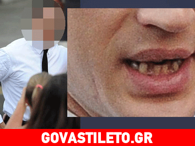 Ηθοποιός του Χόλιγουντ έχει οδοντοστοιχία που… τρομάζει!