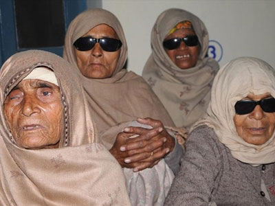 Ινδία: Δεκάδες άτομα τυφλώθηκαν σε μαζικές επεμβάσεις καταρράκτη