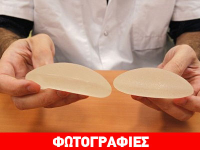 Ισπανία: Έκρυψε ναρκωτικά στα… εμφυτεύματα του στήθους της