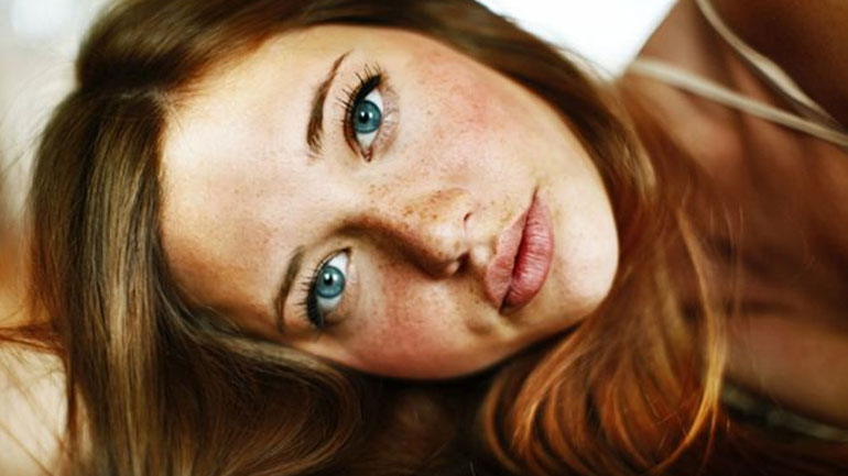 Μείωσε την εμφάνιση φακίδων με φυσικό τρόπο!