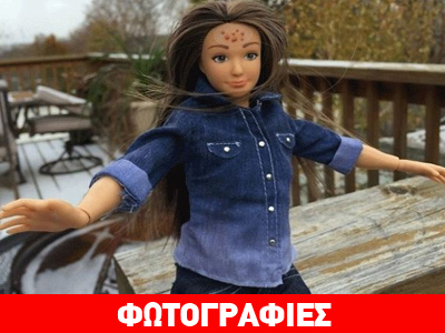 Έρχεται η… αληθινή Barbie: Με ακμή, ραγάδες και κυτταρίτιδα